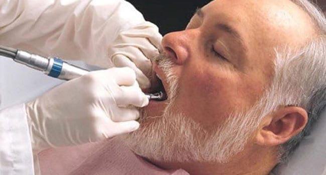 Private dental care fails millions in Ontario